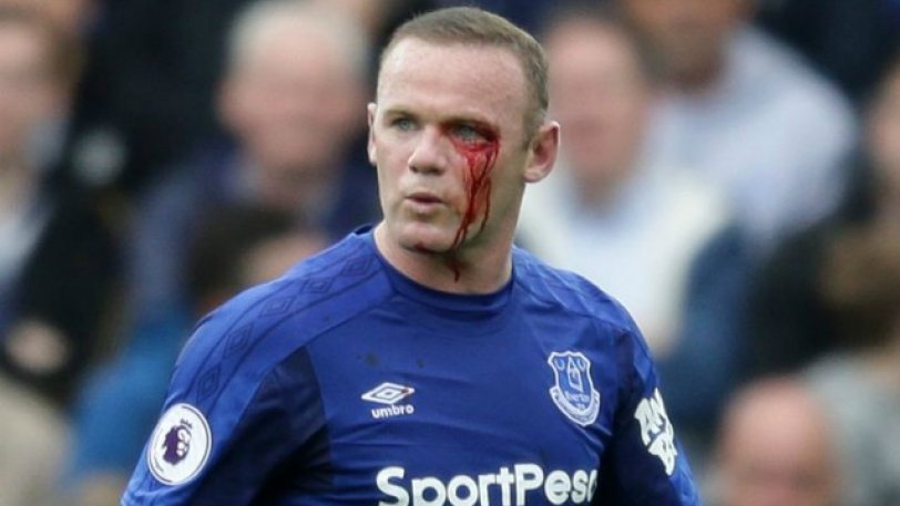 Ο Ρούνεϊ «ματώνει» την φανέλα (vid)