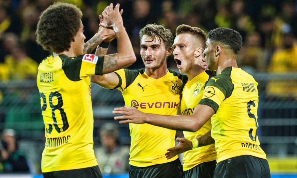 Παίζει… άλλη μπάλα με τέτοια εμφάνιση η Ντόρτμουντ! (pics)