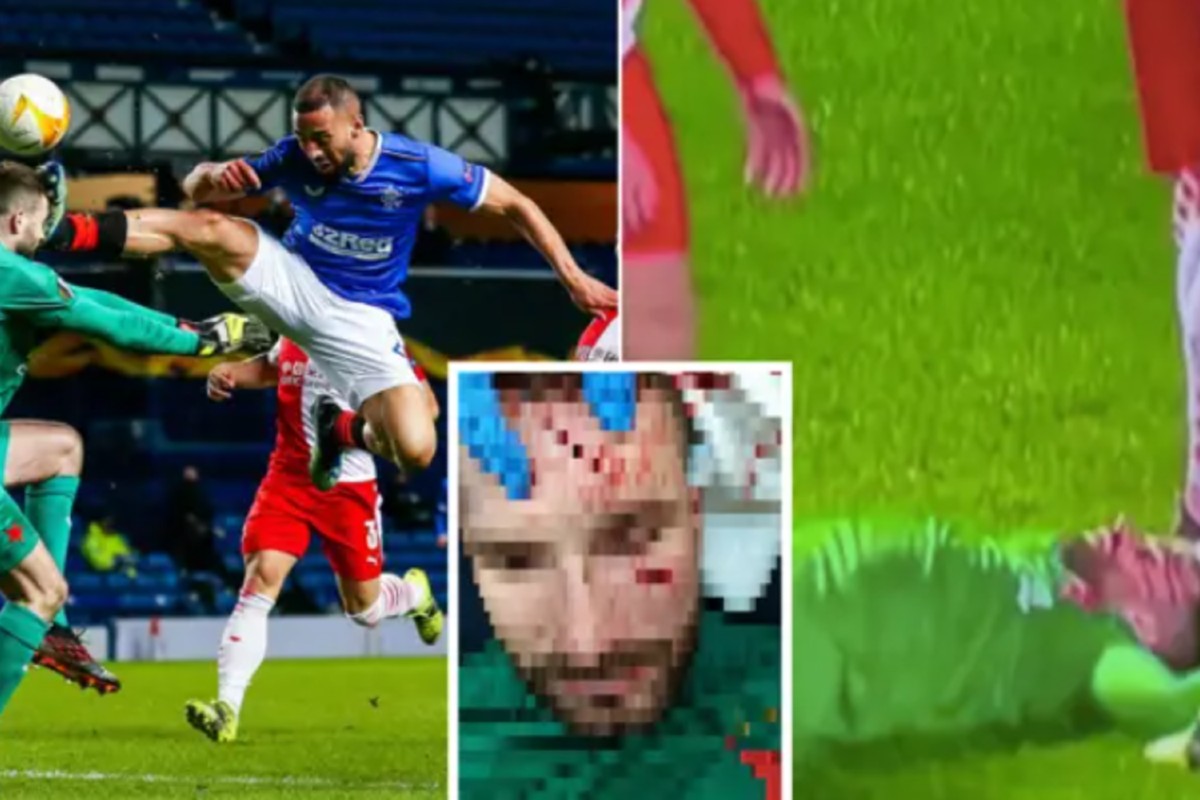 Αγνώριστος ο κίπερ της Σλάβια μετά από εγκληματική προβολή (pic)