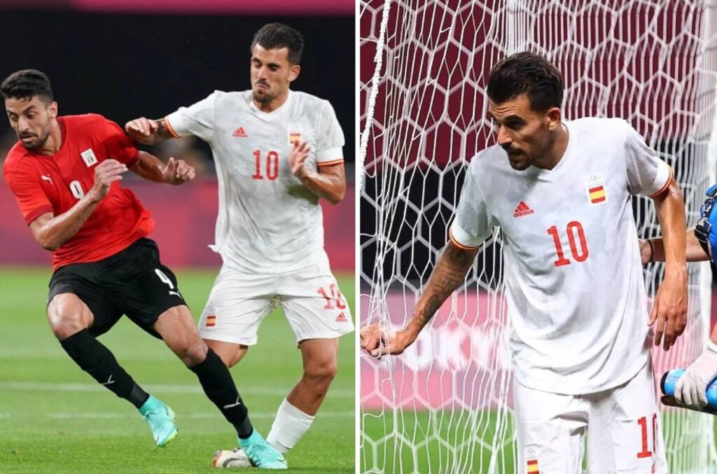 Σοκάρει η εικόνα του πρησμένου ποδιού του Θεμπάγιος! (pic)