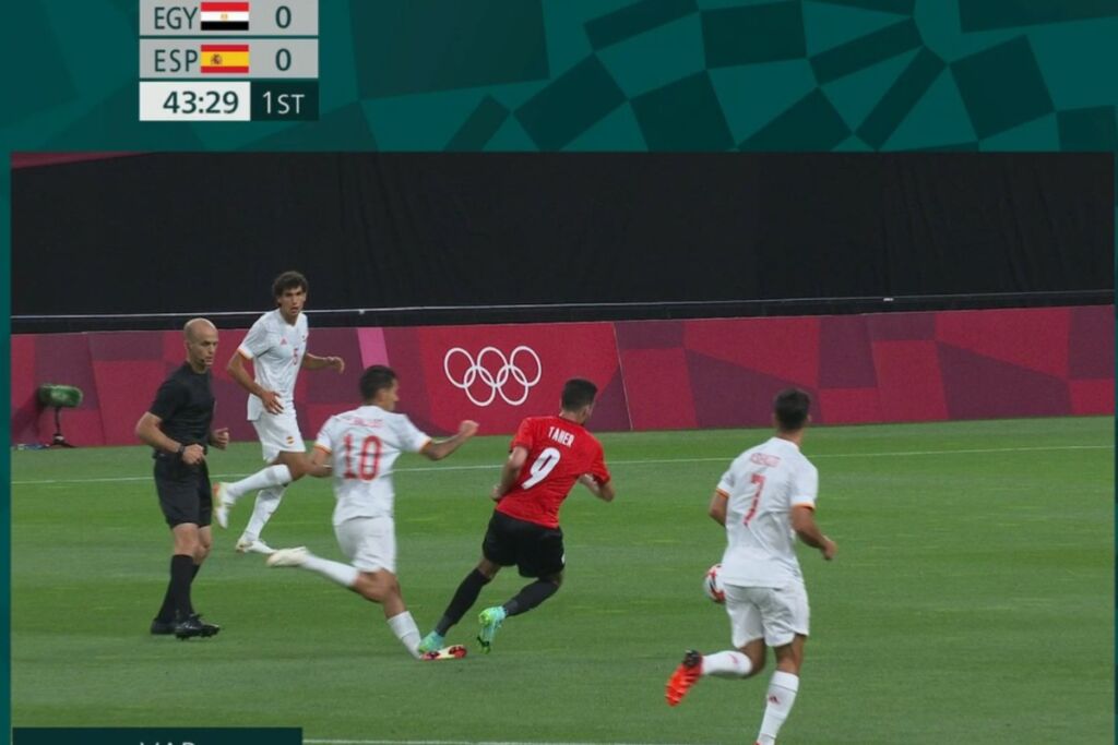 Σοκαριστικός τραυματισμός του Θεμπάγιος – Τούμπανο ο αστράγαλός του (pic)