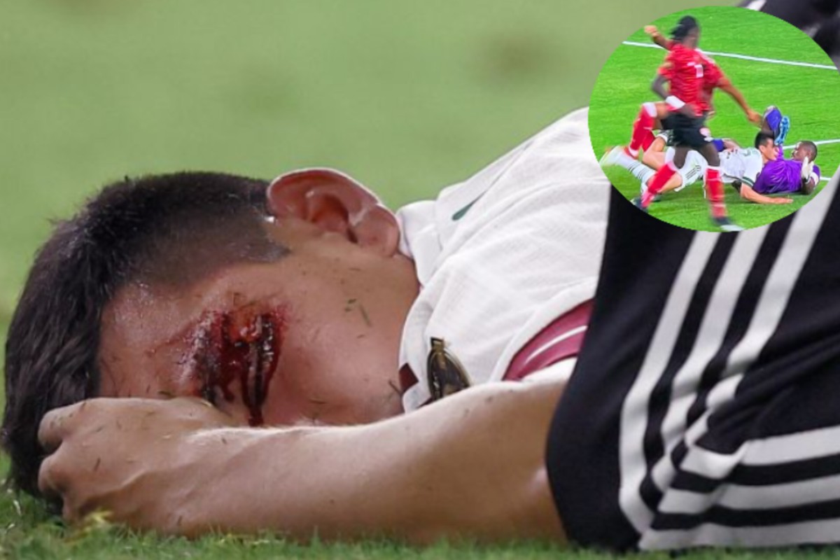 Ο φρικιαστικός τραυματισμός του Ίρβινγκ Λοθάνο (pic)