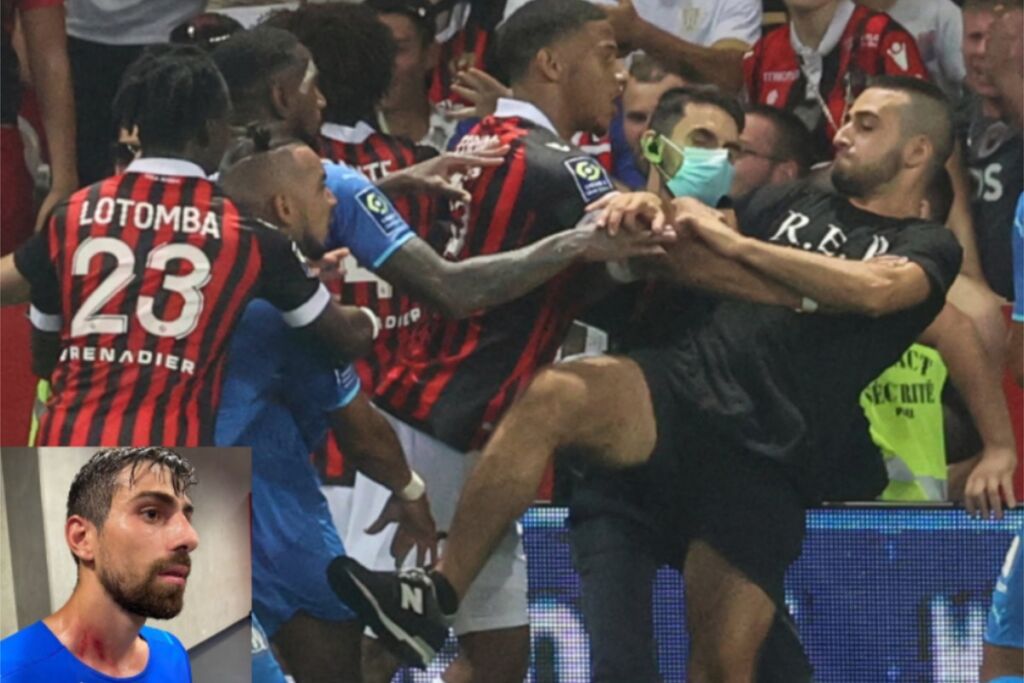 Μαρσέιγ – Νις: Οι μώλωπες μετά τα άγρια επεισόδια (pics)