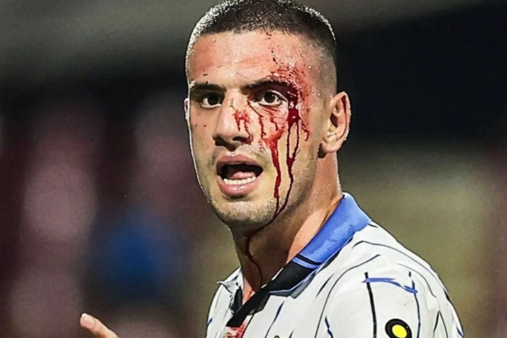 Ντεμιράλ: «Έλαβα κίτρινη κάρτα μετά από αυτό» (pics/vid)