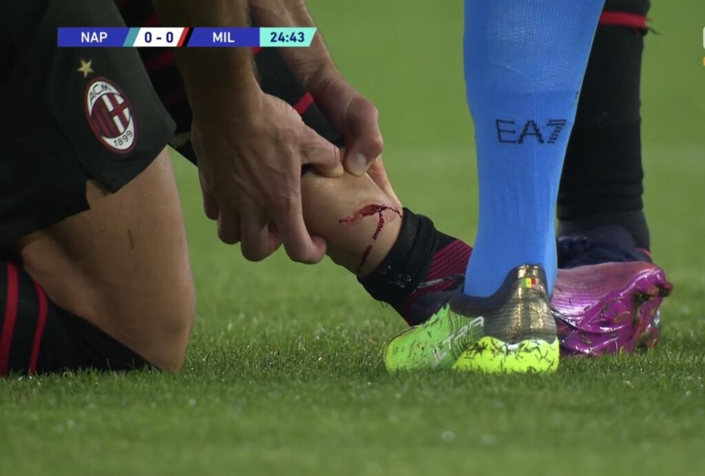 Πολεμιστής Ζιρού! Ο Κουλιμπαλί πήγε να του κόψει την… καριέρα (pics)