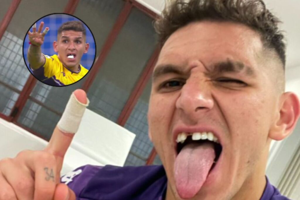 Ο μαχητής Τορέιρα έμεινε φαφούτης – Έχασε το δόντι του (vid/pic)