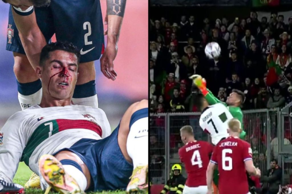 Ο Βάτσλικ πήρε «παραμάζωμα» τον Ρονάλντο – Αιμόφυρτος ο Πορτογάλος (vid)