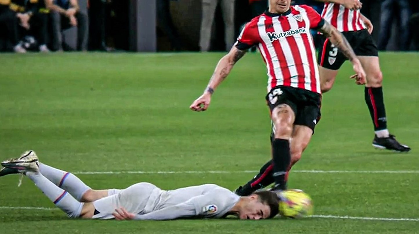 Αυτό θα πει αυτοθυσία: Ο Γκάβι έκανε τάκλιν με το… κεφάλι! (pic)