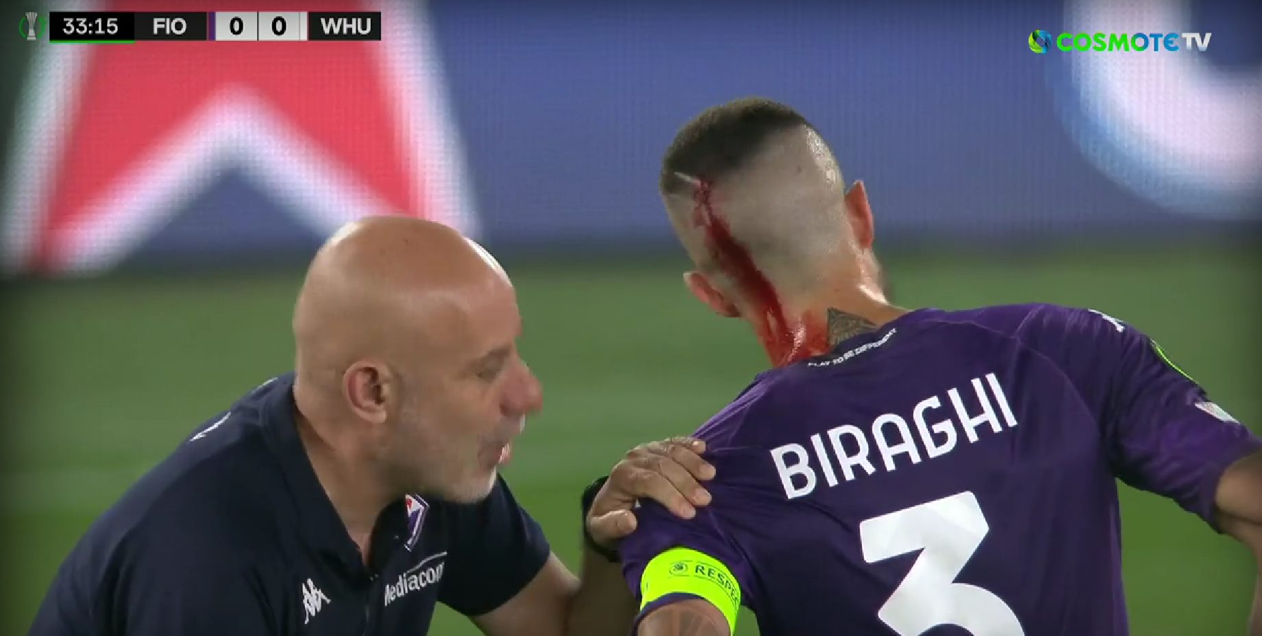 Αλητεία από τους οπαδούς της Γουέστ Χαμ: Άνοιξαν το κεφάλι του Μπιραγκί με τα ποτήρια που πέταξαν! (vid)