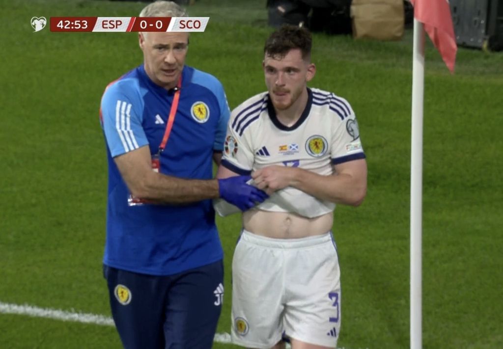 Απρόοπτο για Κλοπ, «ζεσταίνεται» ο Τσιμίκας διότι τραυματίστηκε ο Ρόμπερτσον! (pic)