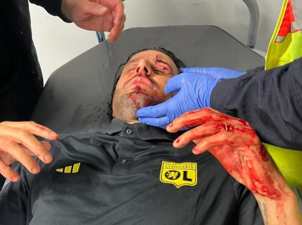 Οπαδοί της Μαρσέιγ πέταξαν πέτρες στο πούλμαν της Λιόν – Χτυπήθηκε ο Γκρόσο! (pics)