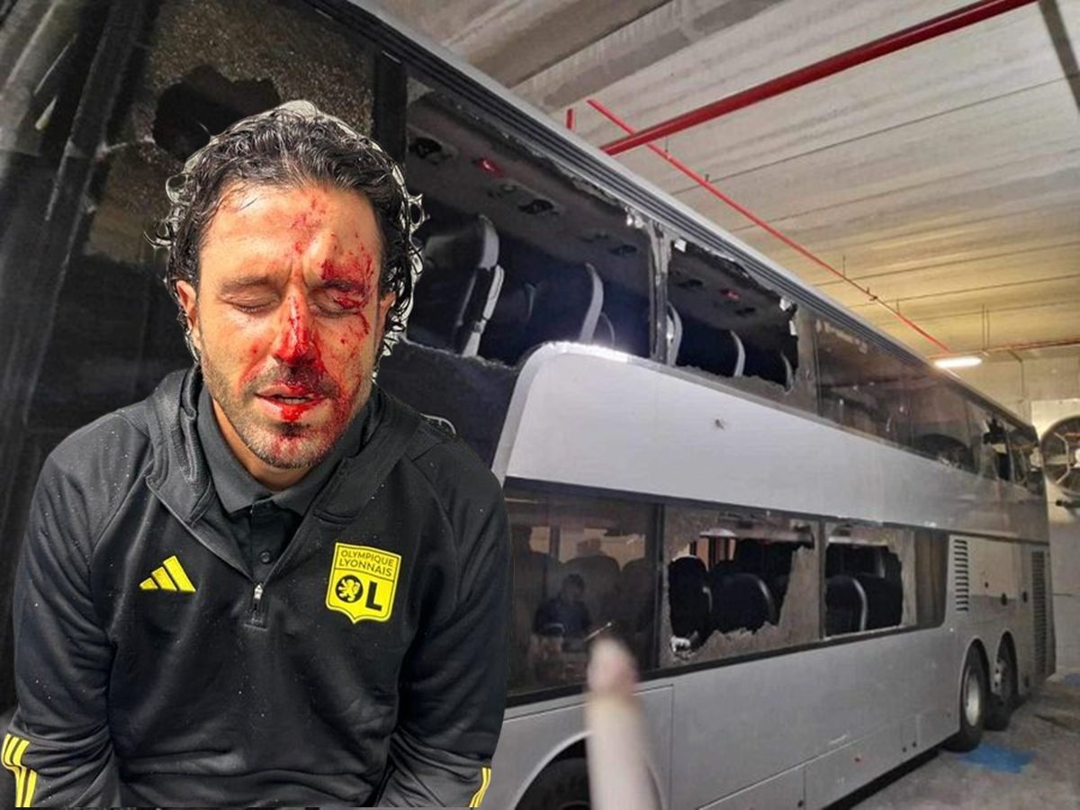 Αναβολή στο Μαρσέιγ – Λιόν μετά τον λιθοβολισμό στον Γκρόσο και το πούλμαν των «λιονέ»