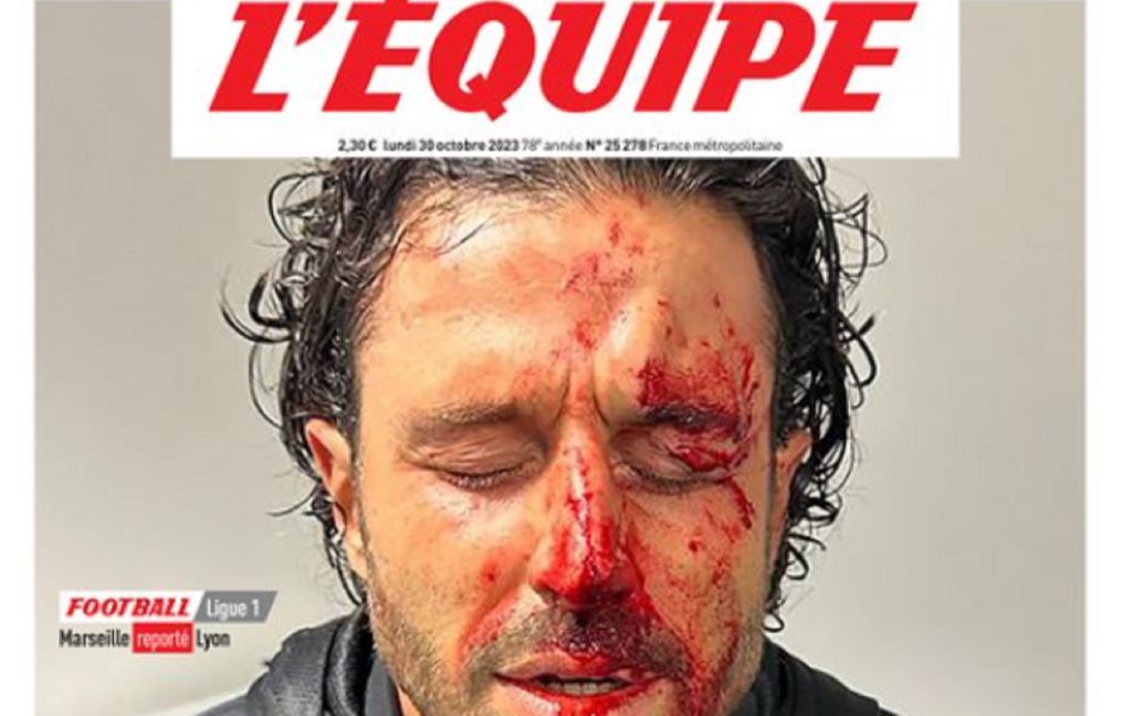 Συγκλονίζει το πρωτοσέλιδο της L’ Equipe με τον αιμόφυρτο Γκρόσο (pic)