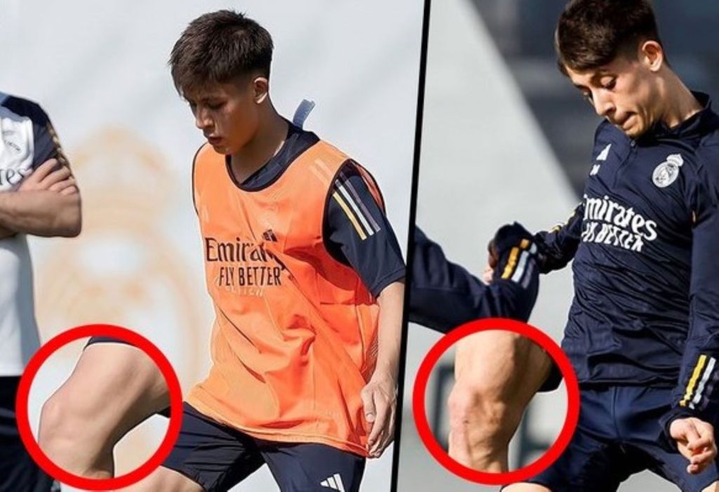 Έγινε… χτιστός ο Γκιουλέρ – Η τρομακτική μεταμόρφωση του αστέρα της Ρεάλ Μαδρίτης (pic)