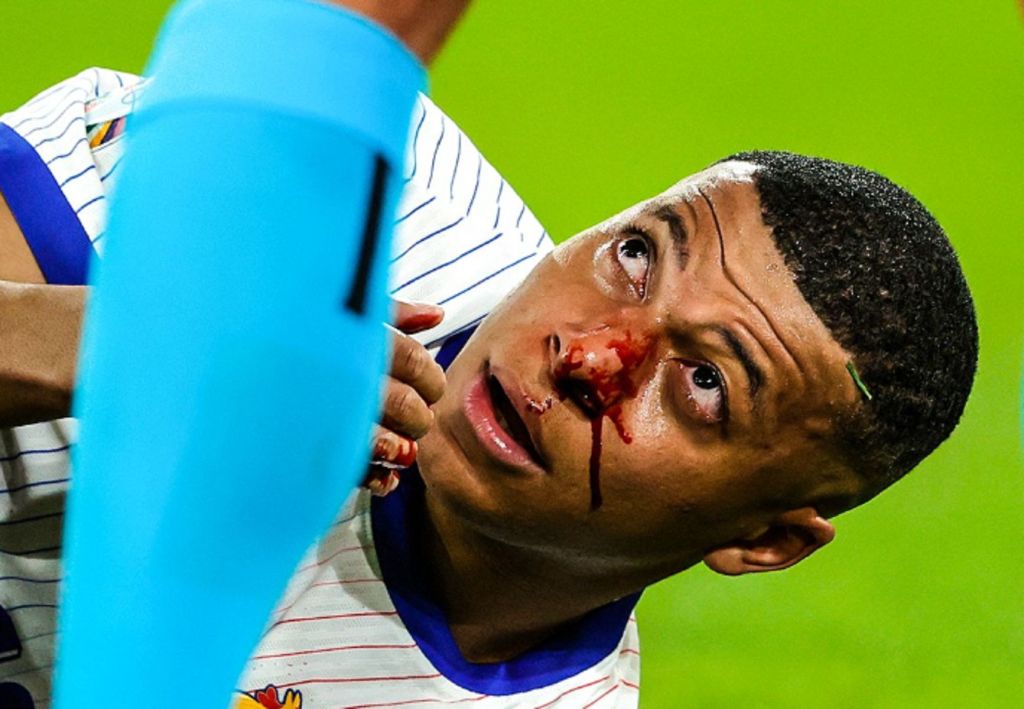 Τεράστια «ζημιά» με Μπαπέ – Χάνει την ματσάρα και η Γαλλία τρέχει!