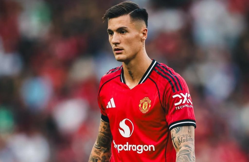 Ο Σέσκο έστειλε δυνατό μήνυμα για τη συνέχεια, μετά την ήττα από την Άρσεναλ! (pic)