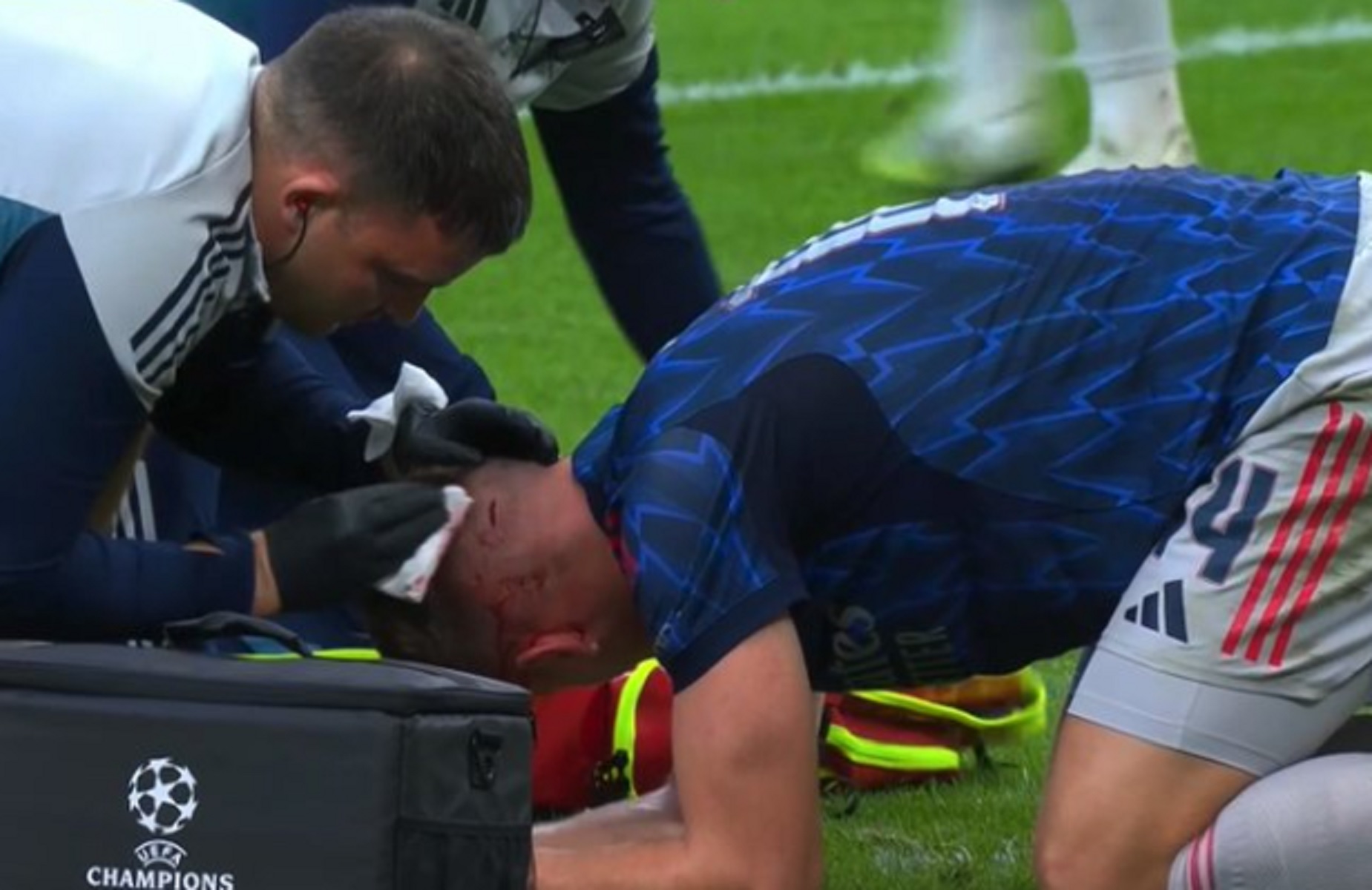 Ο Γκάμπριελ… διέλυσε το κεφάλι του Γιόκερες – Μέσα στα αίματα ο Σουηδός (vid)